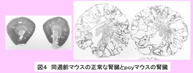 polycystic kidney disease pcy mouse PKD 嚢胞腎