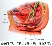 イメージ図