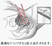 イメージ図